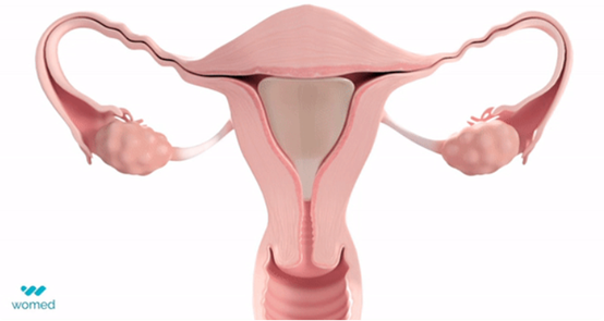 Womed Leaf, US’s First-in-Class degradable film for treating intrauterine adhesion received approval by FDA, Tigermed-Jyton CRO service made great contribution